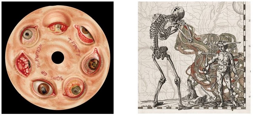 Disc skeleton mellanrum